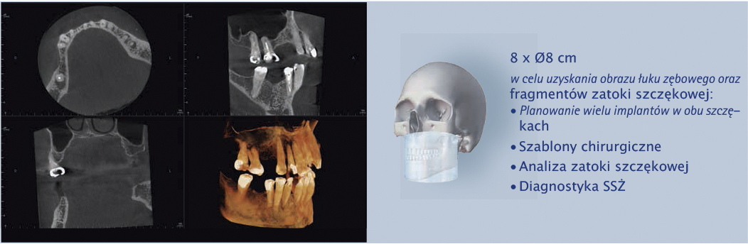 zdjęcia rentgenowskie dla chirurgii