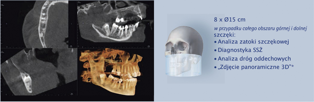rentgen zębów panoramiczny