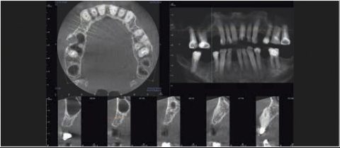 zdjęcia rentgenowskie dla chirurgii stomatologicznej